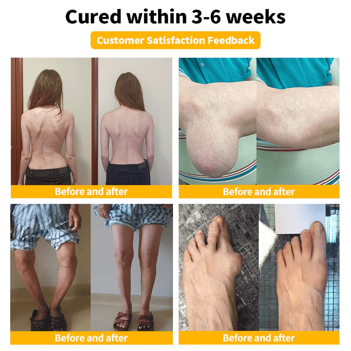 Natural and Immediate Relief for Bones and Joints with Bee Venom