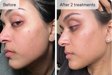 Mona P. before and after