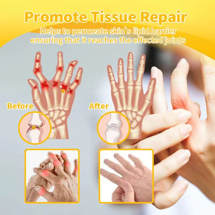 Zentheca BeeThera | Bee Venom-Infused Relief for Bones & Joints