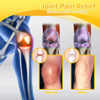Zentheca BeeThera | Bee Venom-Infused Relief for Bones & Joints