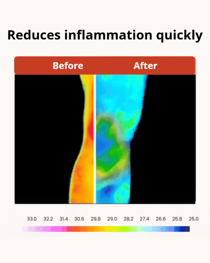 Natural and Immediate Relief for Bones and Joints with Bee Venom