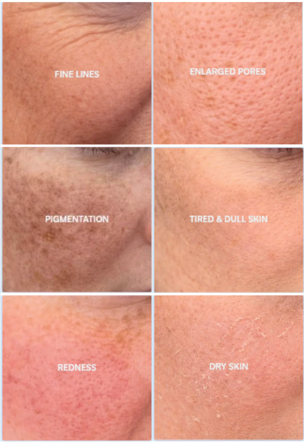 COLLAGEN, THE KEY TO YOUTHFUL, RADIANT SKIN
