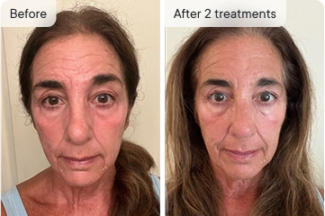 Andrea before and after