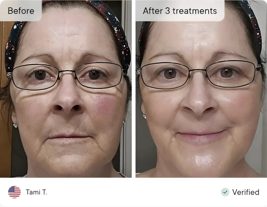 Tami T. before and after